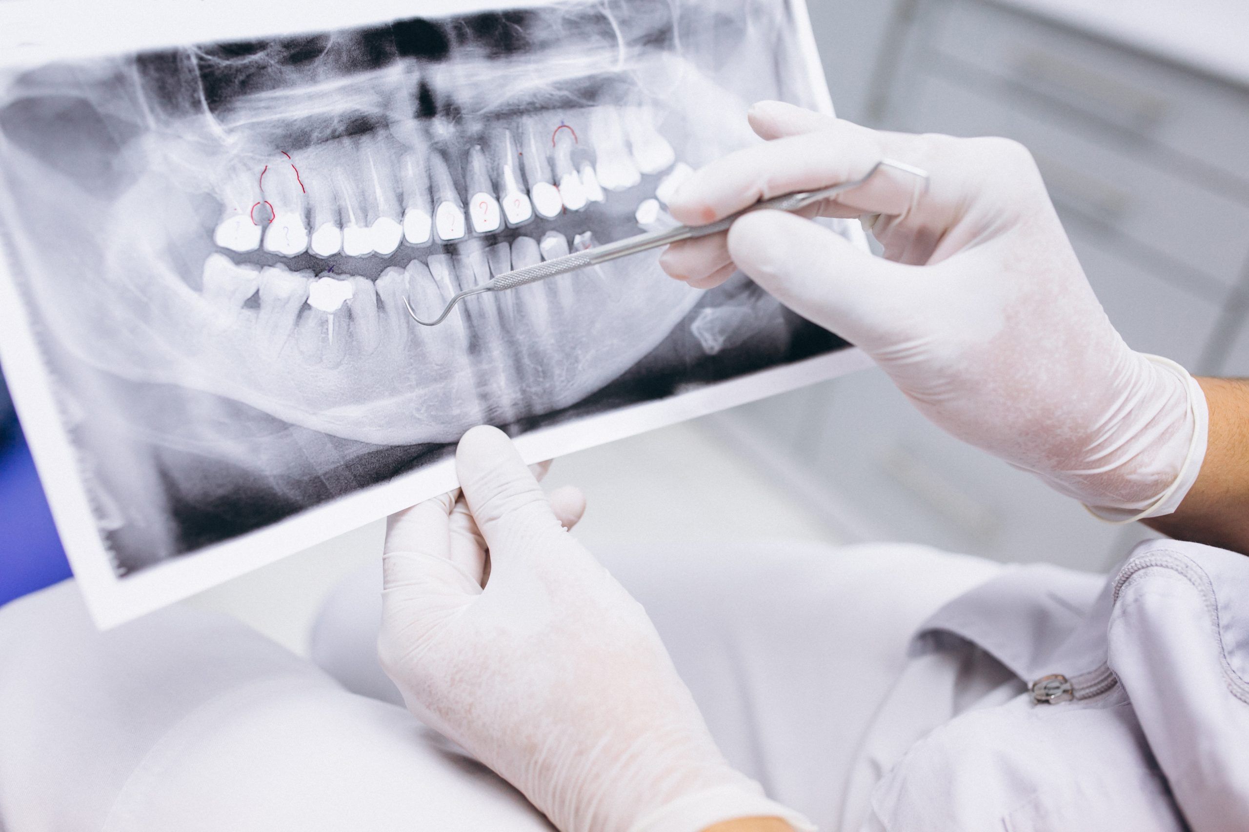Implante dental