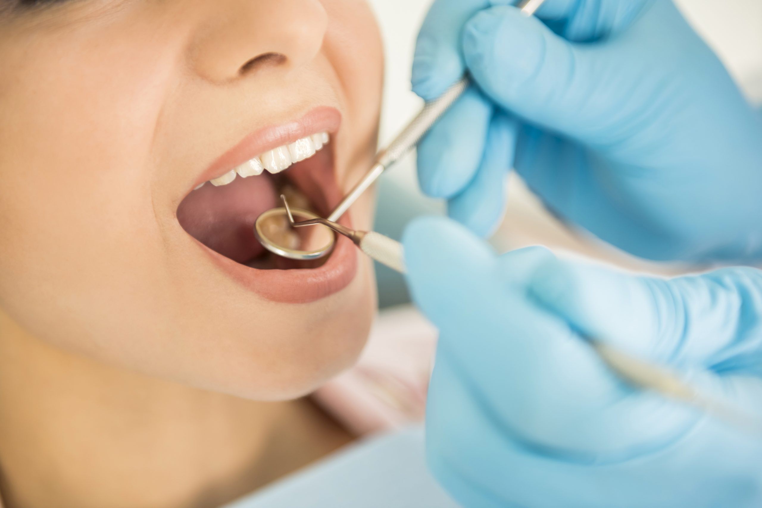 endodoncia antes y después