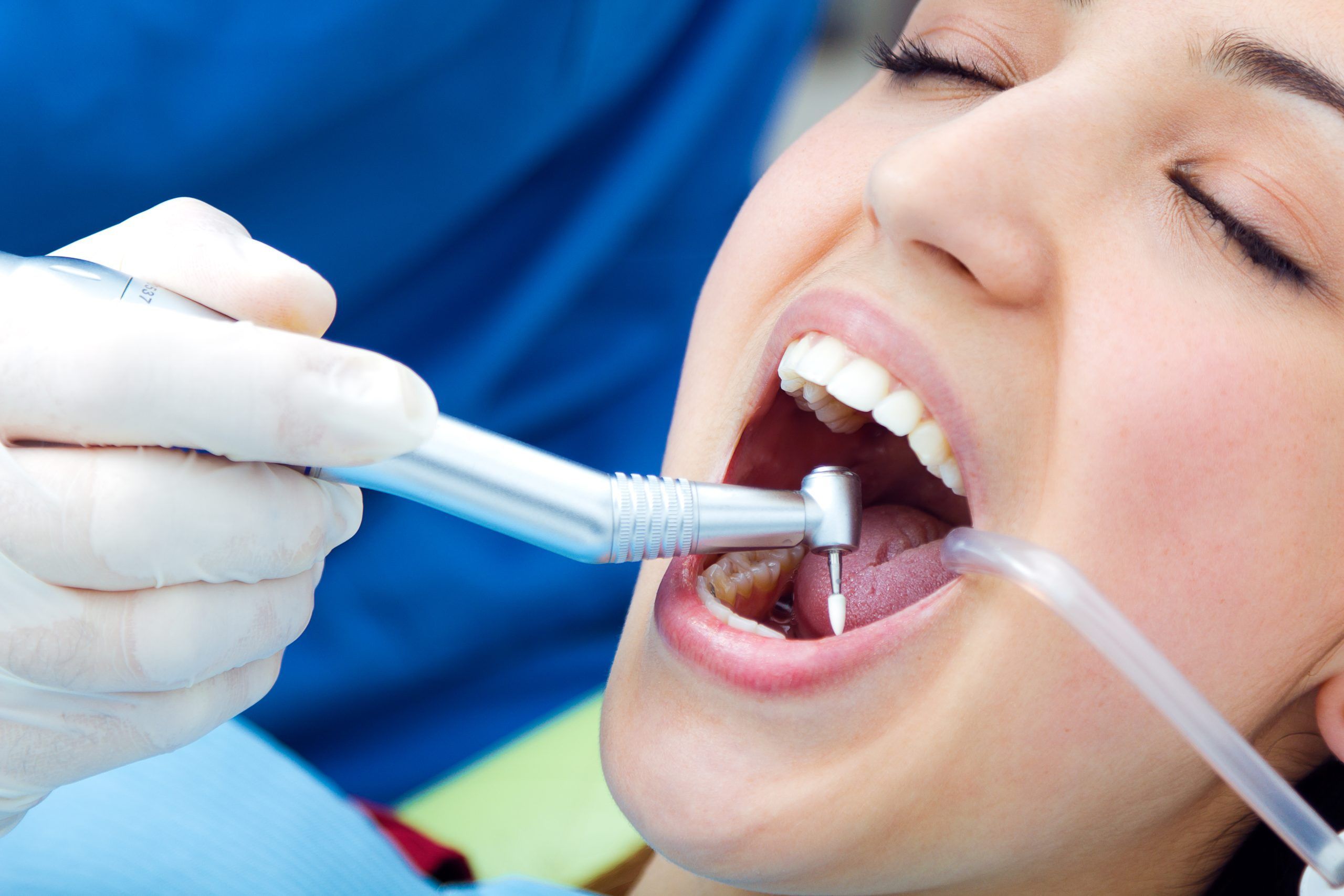 Periodoncia antes y después