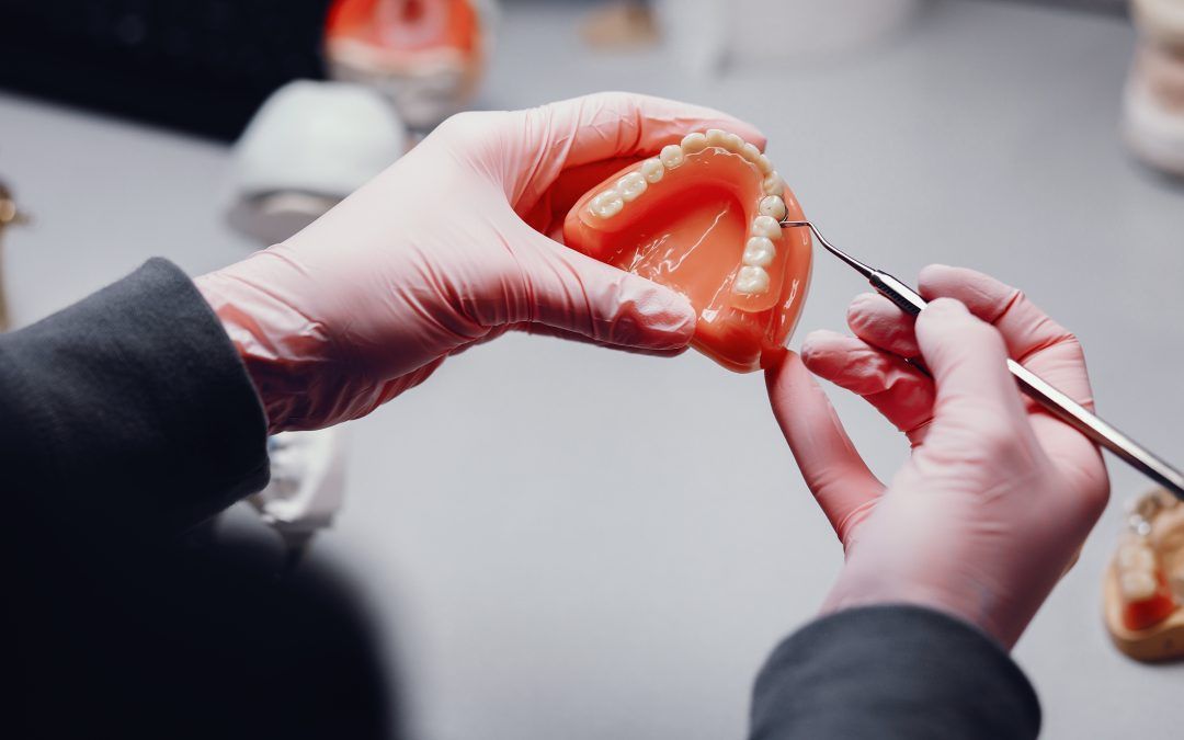 Prótesis dental